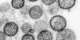 What Is Hantavirus? Everything You Need to Know And What Happened on the MV Hondius