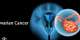 No Woman Left Behind: World Ovarian Cancer Day 2026 A Call to Action for Ghana and West Africa