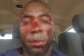 Tensions flare in Binduri as newly elected PM beaten after DCE nominee was rejected