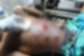 Fresh shooting shatters fragile calm in Nkwanta South, Okada rider shot