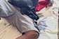 Army recruit loses hand during the clash
