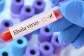 Ghana has not recorded any case of Ebola — Health Ministry dismisses false reports