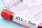 One in every three Ghanaians living with HIV unaware — AIDS Commission