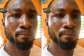 Doctors remove motorbike key from farmers skull after attempting to separate fight at Amenyo