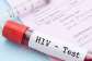 1,300 reactive HIV tests during security recruitment not confirmed diagnoses — AIDS Commission