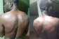 Sandema carpenter hospitalized after alleged military brutality for calling on govt to fix Chuchuliga-Sandema-Wiesi road