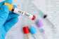 AIDS Commission explains why more women test HIV positive than men