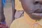Mysterious illness leaves children struggling to walk, hear in Mafi Kope