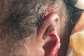 Victim showing her bitten ear