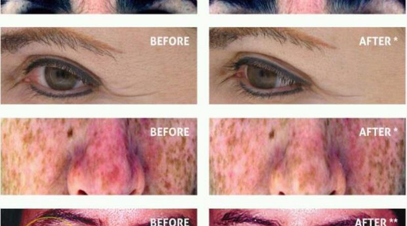 Neocell Collagen Before And After