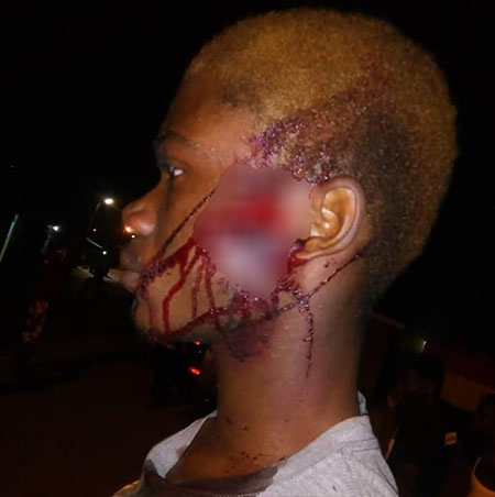 Assembly Race Turns Bloody At Tema Newtown