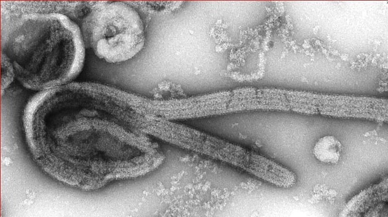 Ethiopia confirms outbreak of deadly Marburg virus: Africa CD