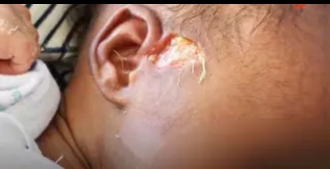 Medical Negligence in Ghana: When Birth Becomes Harm The Case of Jasikan District Hospital