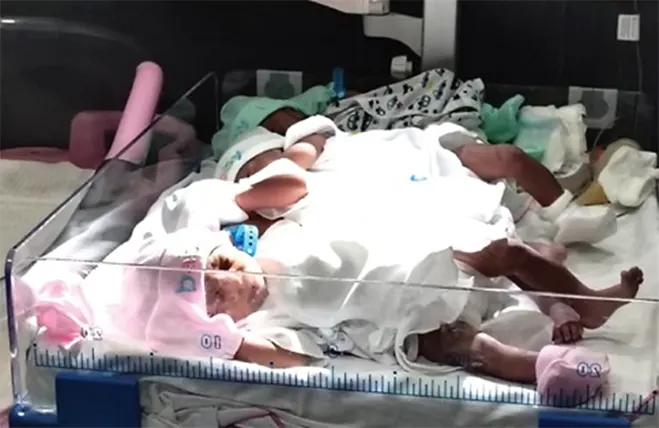 Surrogate mother delivers quadruplets through IUI in Ghana