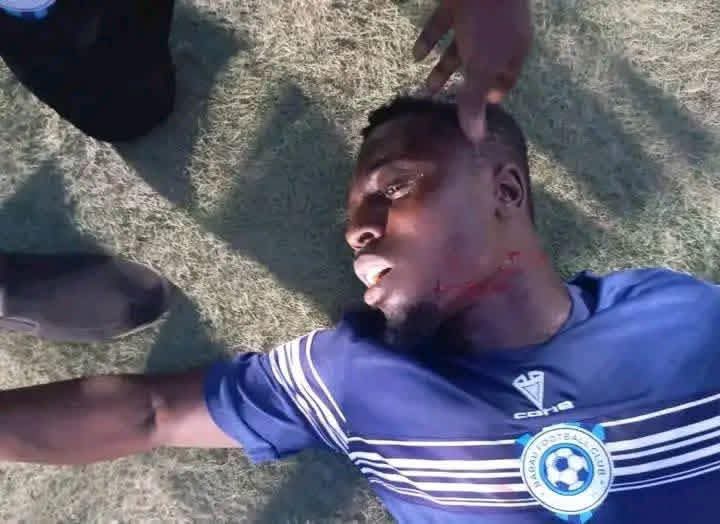 Ghanaian midfielder Nana Kwame Abraham has throat slit by Katsina United fan