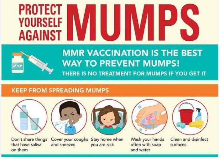 Mumps outbreak hits Keta
