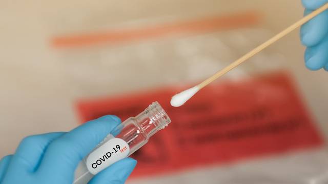 COVID-19: UHAS offers walk-in COVID-19 test services - Vimarsana News