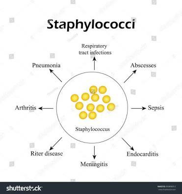 The Deception Of Staph! There's No Such Disease Called Staph