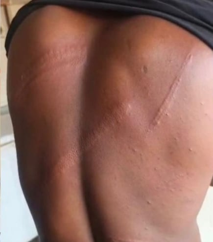 Military Assault on Media General Correspondent Sparks Outcr...