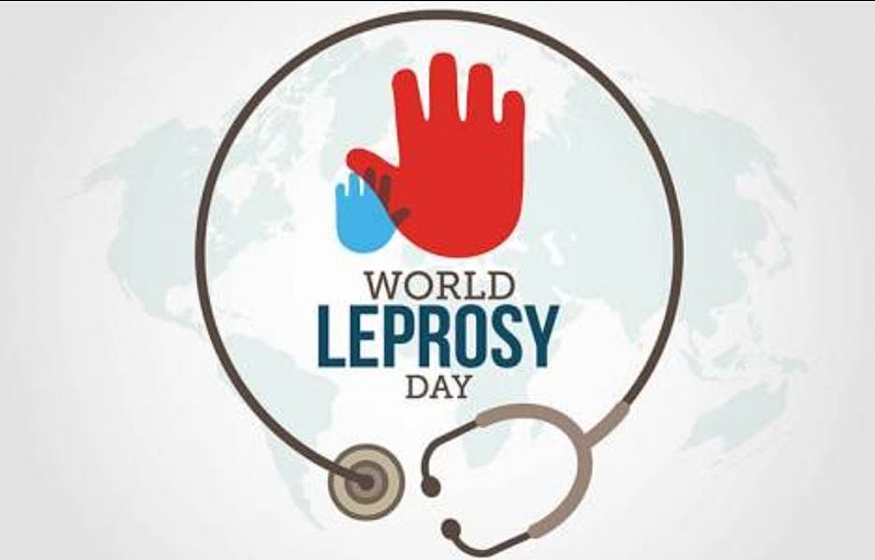 Leprosy still exists - help us to overcome this disease.