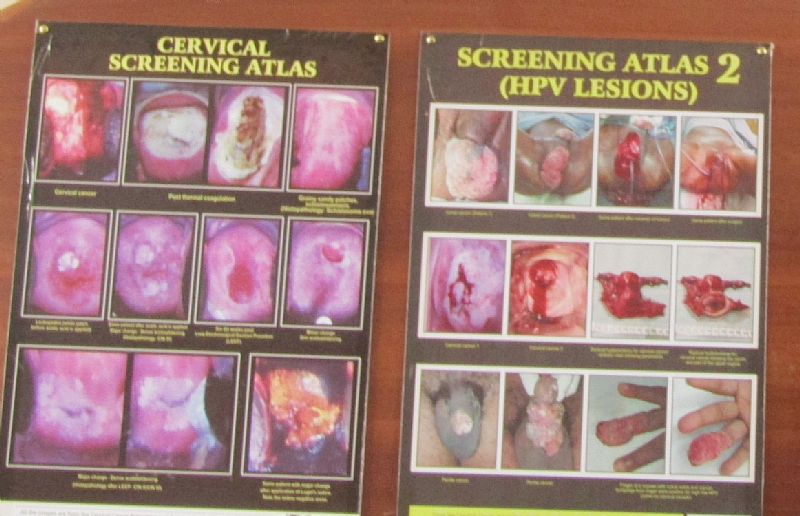 Life cannot be quantified, cervical cancer screening is a must – IMaH ...