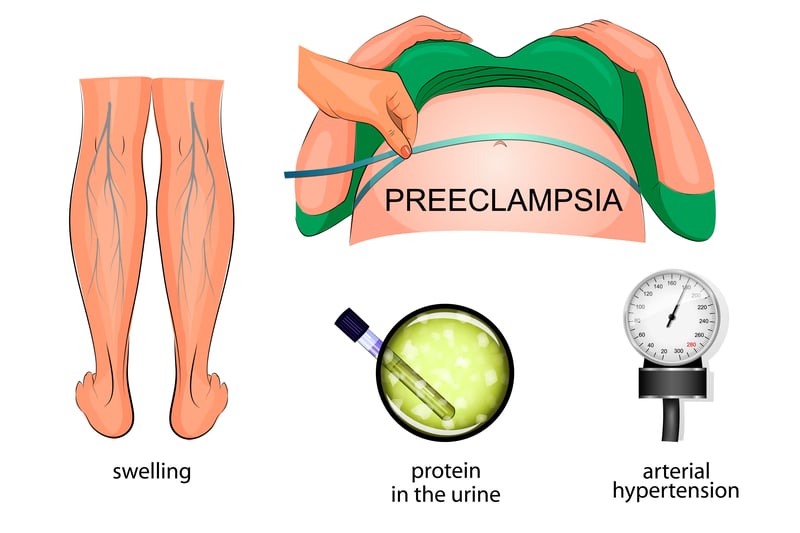 preeclampsia-leading-cause-of-maternal-mortality