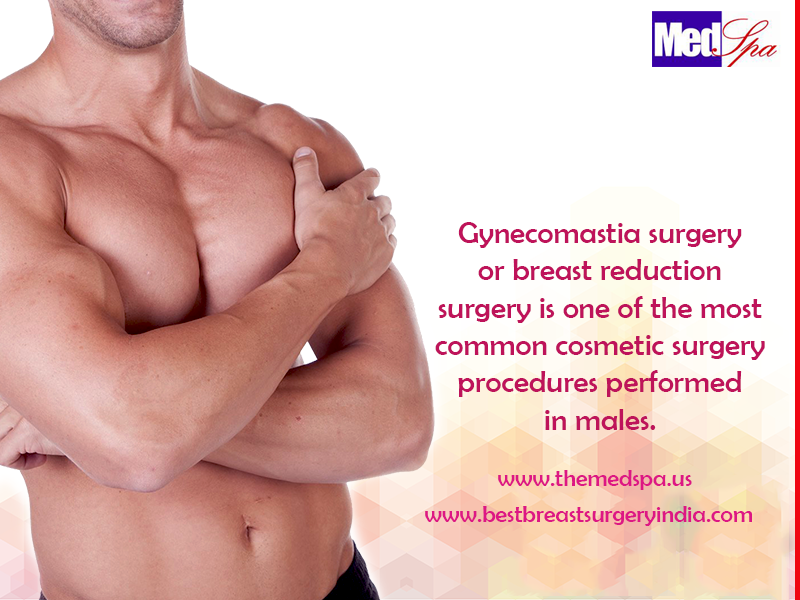 Gynecomastia surgery in Delhi – Causes for excessive large breasts