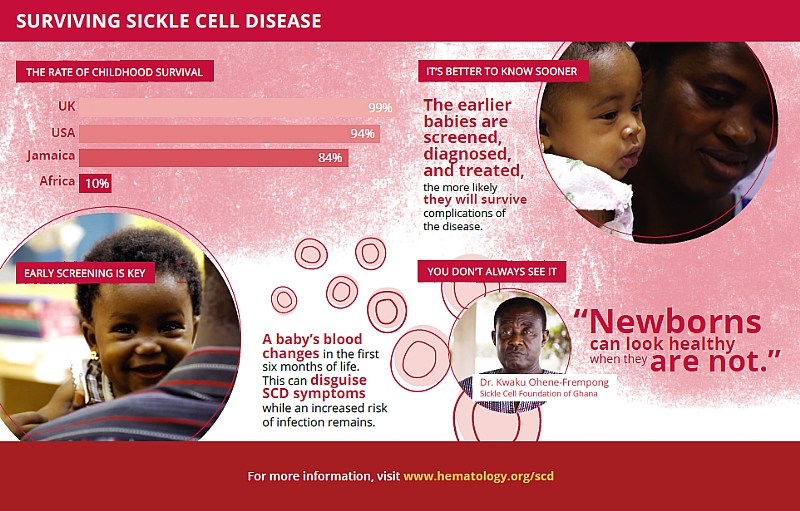 On World Sickle Cell Day 2018—Ash Takes Action To Improve Global Health ...