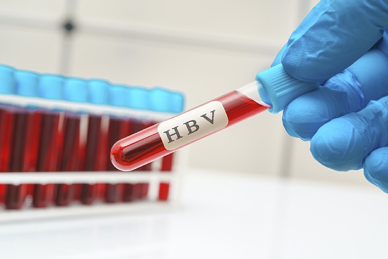 Hepatitis B is a life-threatening liver infection – our machine learning tool could help with early detection - Vimarsana News