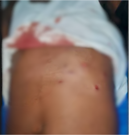 Two sustain gun wounds in Mankrong Nkwanta robbery