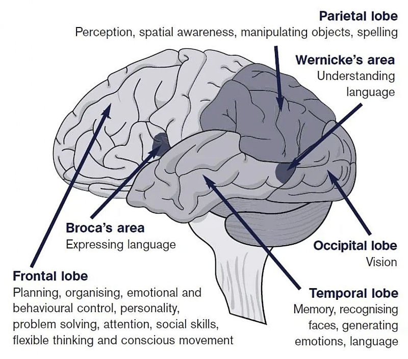 all-about-anoxic-brain-injury-the-injury-suffered-by-anne-heche