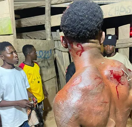 25-year-old man allegedly assaulted over fake gold at Mfante-Asikam