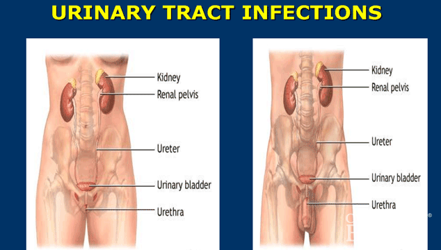 Why Your Urinary Tract Infection Is Still A Problem