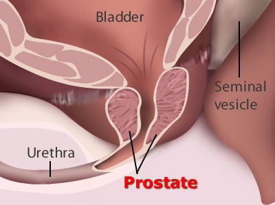mistænksom skruenøgle negativ Let Talk About Sex And Prostate Health: What Men And Women Need To Know For  Optimum Prostate Health(11)