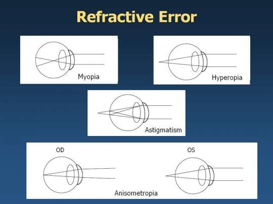 what are uncorrected refractive errors