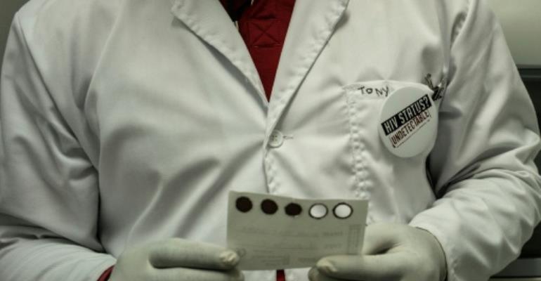One in two Africans don\'t know HIV status: expert