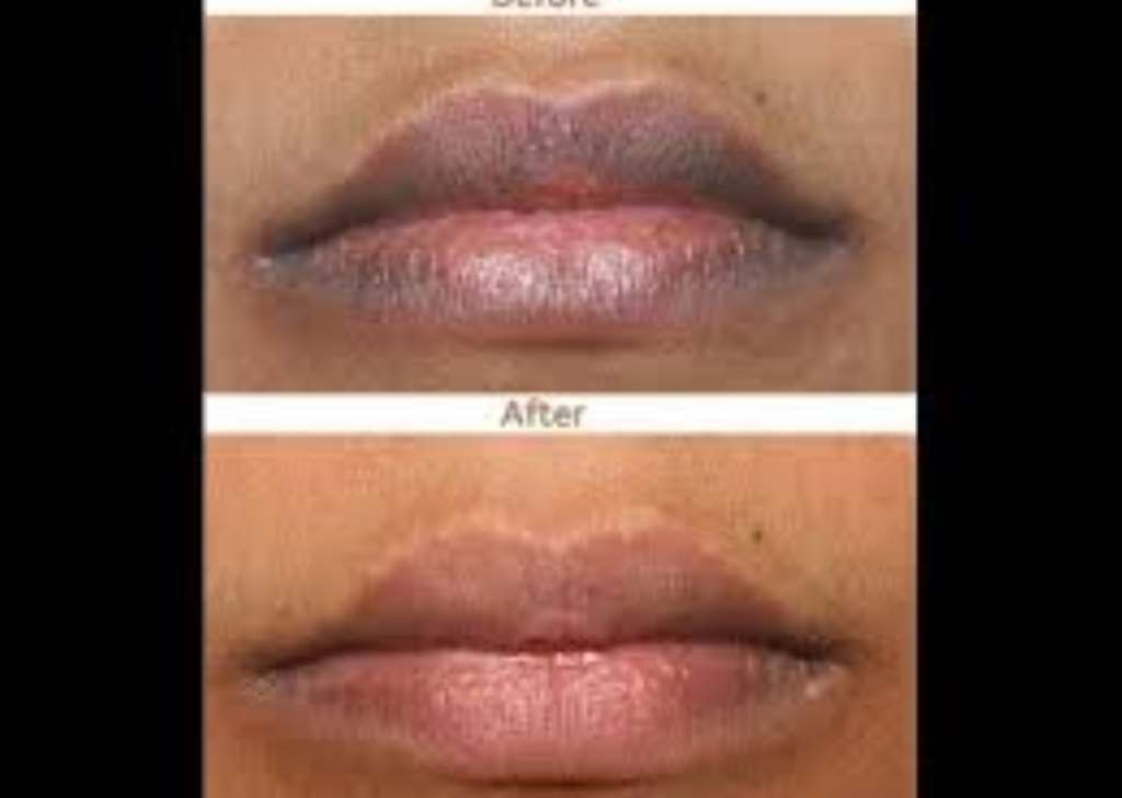 My Lips Are Always Dry Why | Sitelip.org