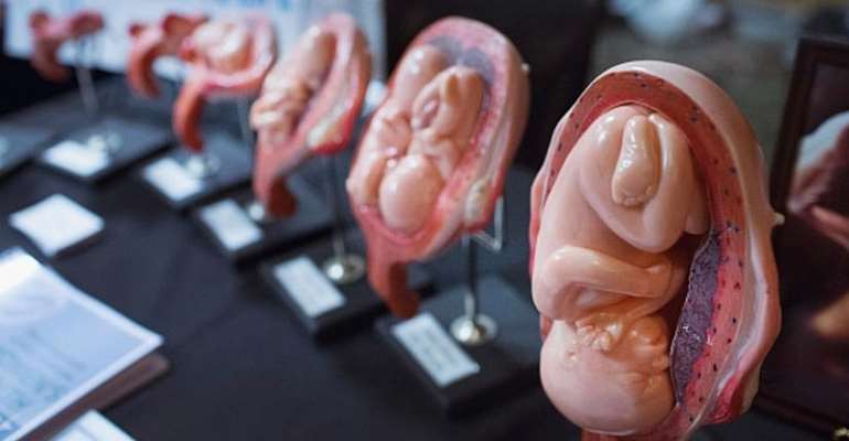 Ghana Records 200,000 Abortions In 2017 – Report