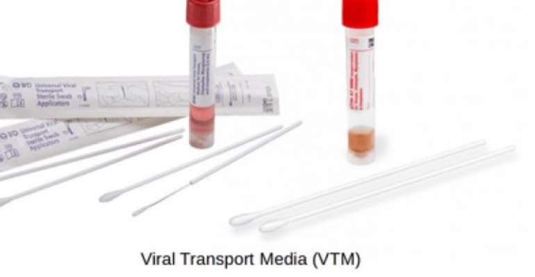 COVID-19: Shortage of test kits hit hospitals in Accra