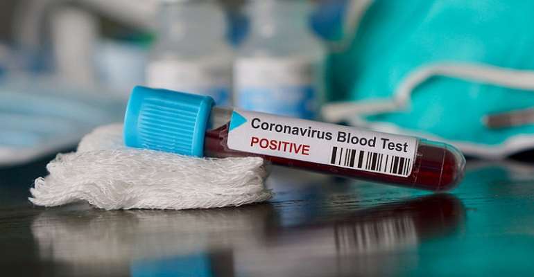 COVID19: Ghana records three more deaths as total active cases hit 2,413