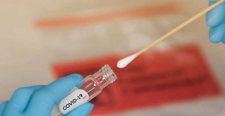 COVID-19: UHAS offers walk-in COVID-19 test services