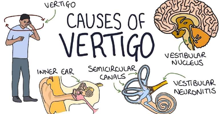 Are you suffering from Vertigo? These tips can be handy
