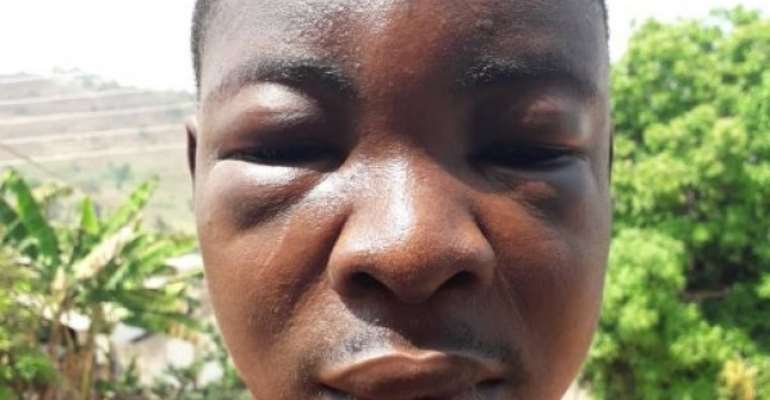 V/R: Farmer jailed 20 years for robbery