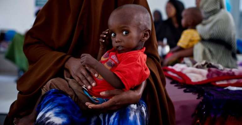 Eid Abdi Muhammed, 18 months old, in the stabilisation ward for severely malnourished children in Hargeisa, Somaliland. Photograph: Kate Holt/Unicef