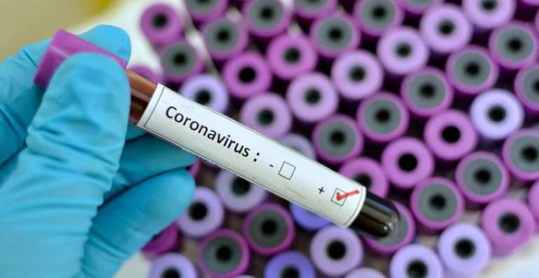 Coronavirus: 151 Contacts Have Been Traced – Dr. Badu Sarkodie