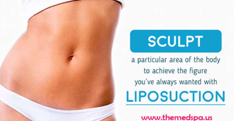 liposuction in Delhi