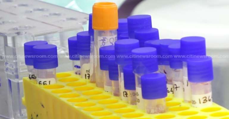 Ghana’s COVID-19 Cases Rise To 27,060; Death Toll Now 145