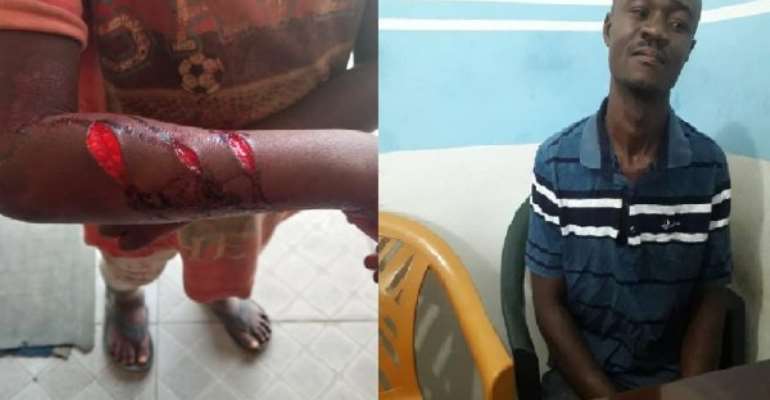 Father Cuts 4-Year-Old Boy Arm With Blade For Stealing Chicken Wings