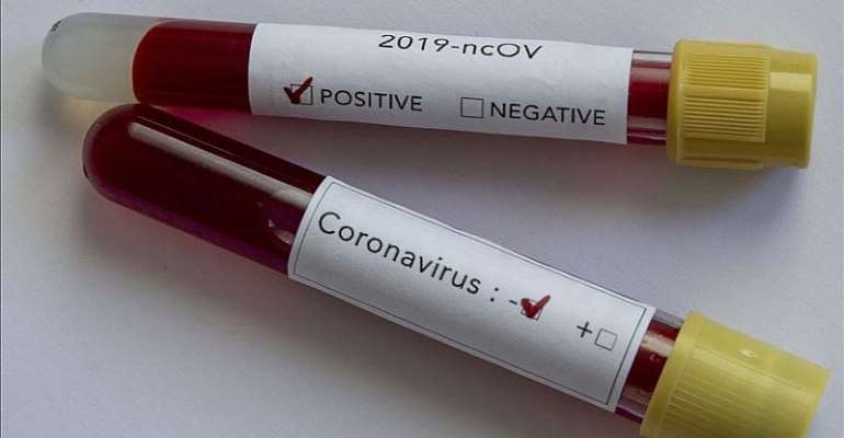 Covid-19: Global Cases Exceed 11million