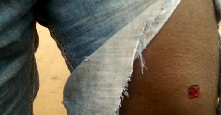 A gun wound on one of the demonstrators